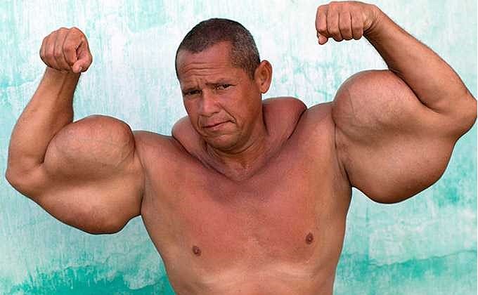 Poznáš synthol, takto to dopadne, keď sa to s ním preženie